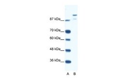 HKR1 Antibody, Novus Biologicals 100 &mu;L; Unconjugated:Antibodies, Polyclonal